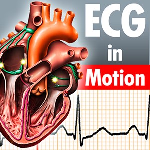 ECGinMotion - Microsoft key - South Africa